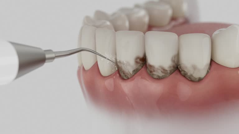 Reliable Dental contractor in Trotwood, OH by Dentist Open Now